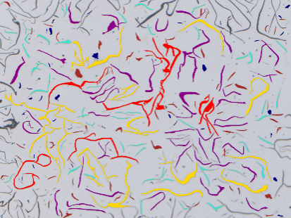 Tecnicas de contraste microscopio zeiss observer